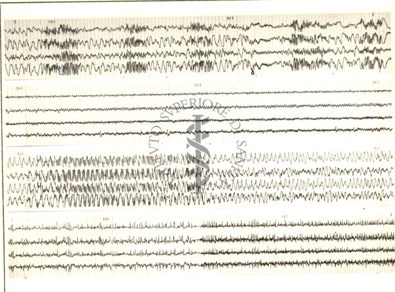 Tracciati elettroencefalografici di coniglio