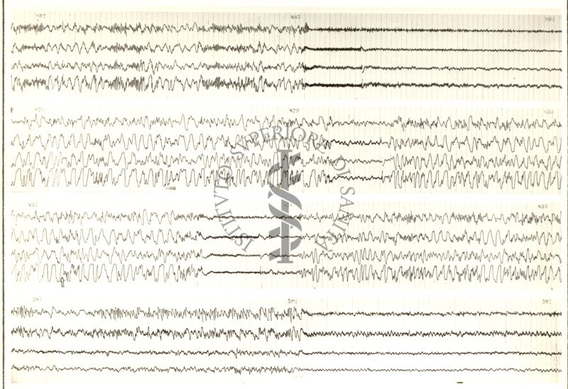 Tracciati elettroencefalografici di coniglio