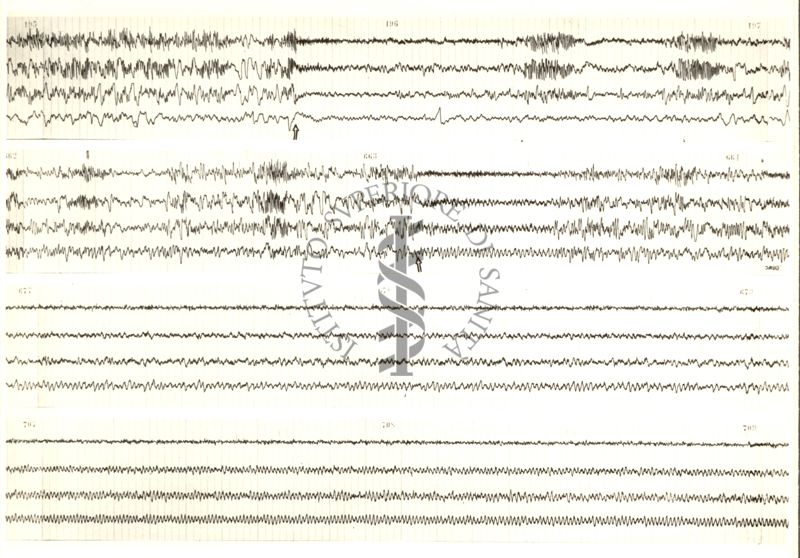 Tracciati elettroencefalografici di coniglio