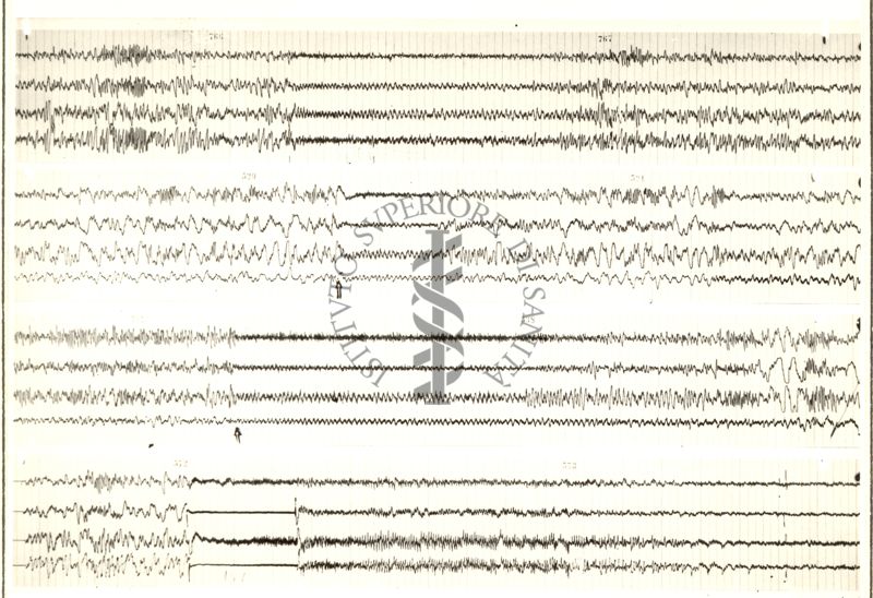 Tracciati elettroencefalografici di coniglio