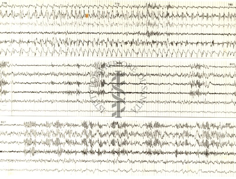 Tracciati elettroencefalografici