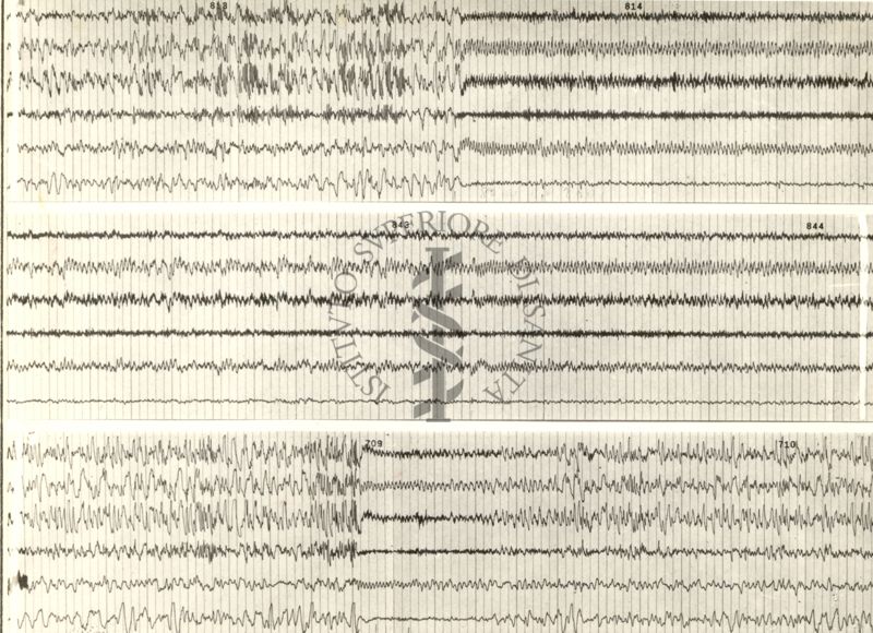 Tracciati elettroencefalografici