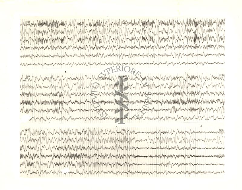 Tracciati elettroencefalografici