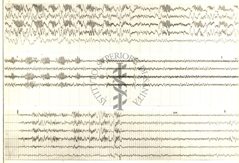 Tracciati elettroencefalografici di coniglio