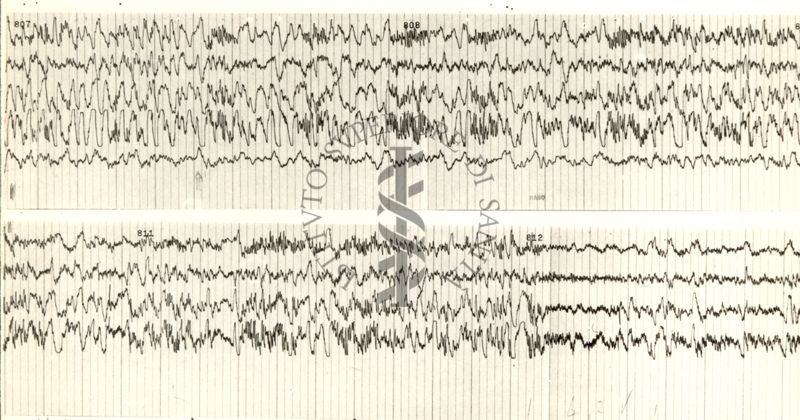 Tracciati elettroencefalografici di coniglio