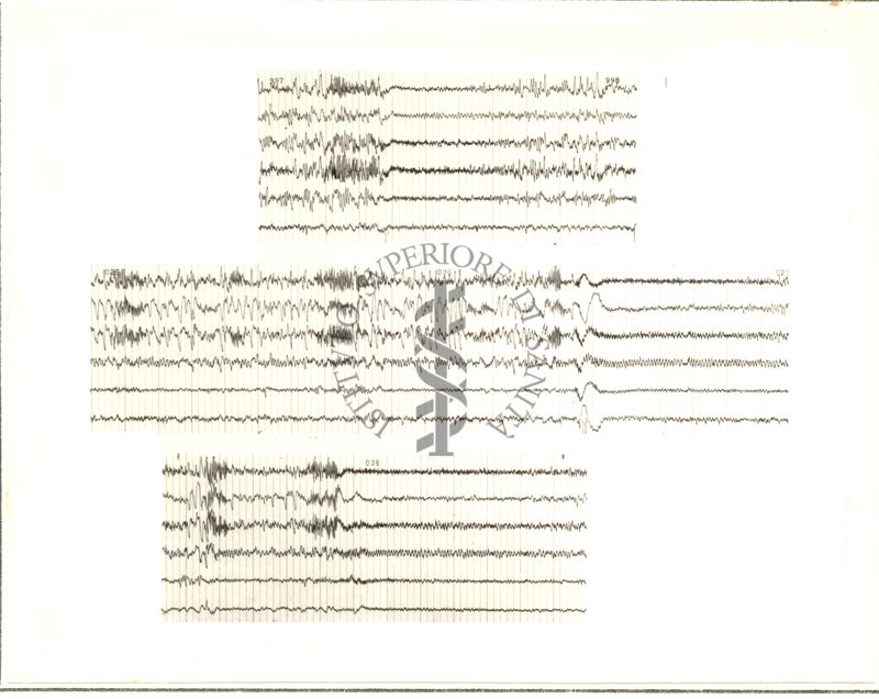 Tracciati elettroencefalografici