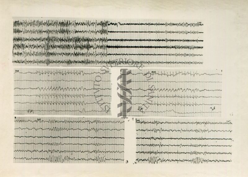 Tracciati elettroencefalografici di coniglio