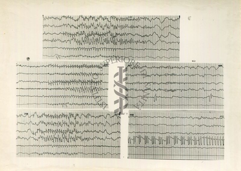 Tracciati elettroencefalografici di coniglio