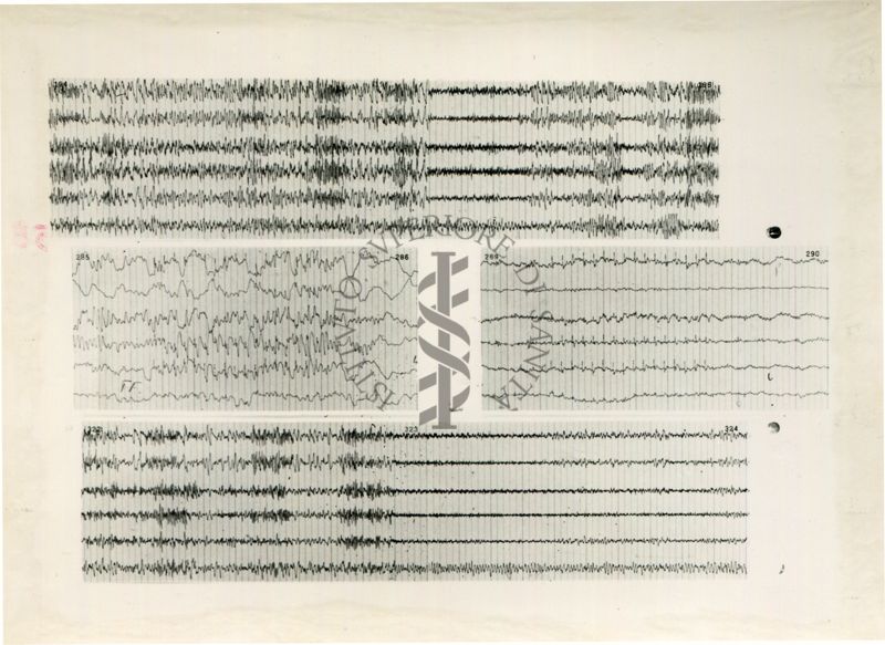 Tracciati elettroencefalografici di coniglio