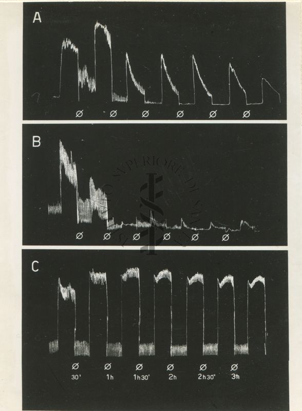 Diagrammi riproducenti l'attività spontanea e risposte all'acetilcolina dell'intestino isolato di coniglio