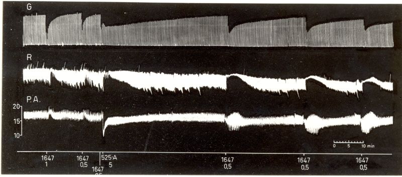 Potenziamento del prodotto S.K.F. 525 A dell'attività curarizzante dei curari di sintesi