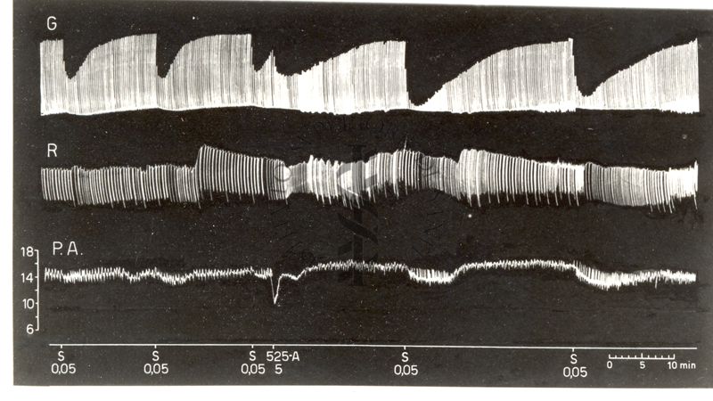 Potenziamento del prodotto S.K.F. 525 A dell'attività curarizzante dei curari di sintesi