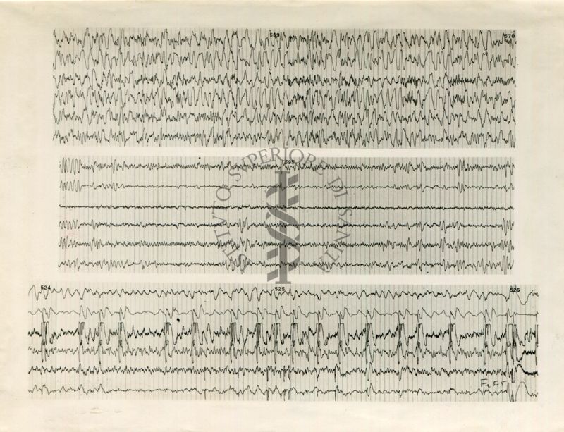 Tracciati elettroencefalografici di coniglio