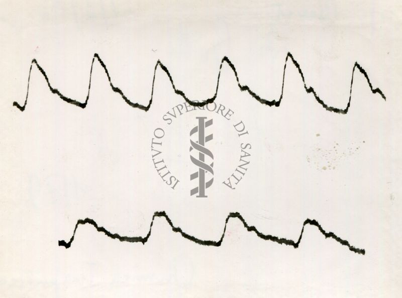 Registrazione piezografica del polso dell'arteria temporale nell'uomo sotto effetto di vari farmaci