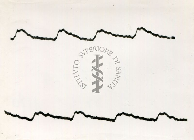 Registrazione piezografica del polso dell'arteria temporale nell'uomo sotto effetto di vari farmaci