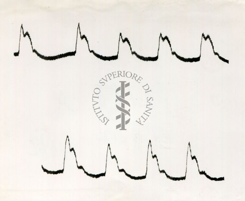 Registrazione piezografica del polso dell'arteria temporale nell'uomo sotto effetto di vari farmaci