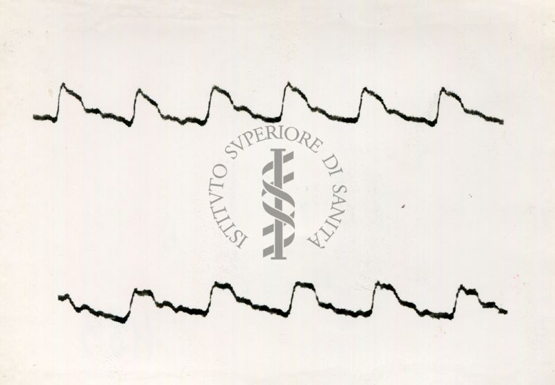Registrazione piezografica del polso dell'arteria temporale nell'uomo sotto effetto di vari farmaci