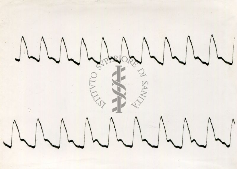 Registrazione piezografica del polso dell'arteria temporale nell'uomo sotto effetto di vari farmaci