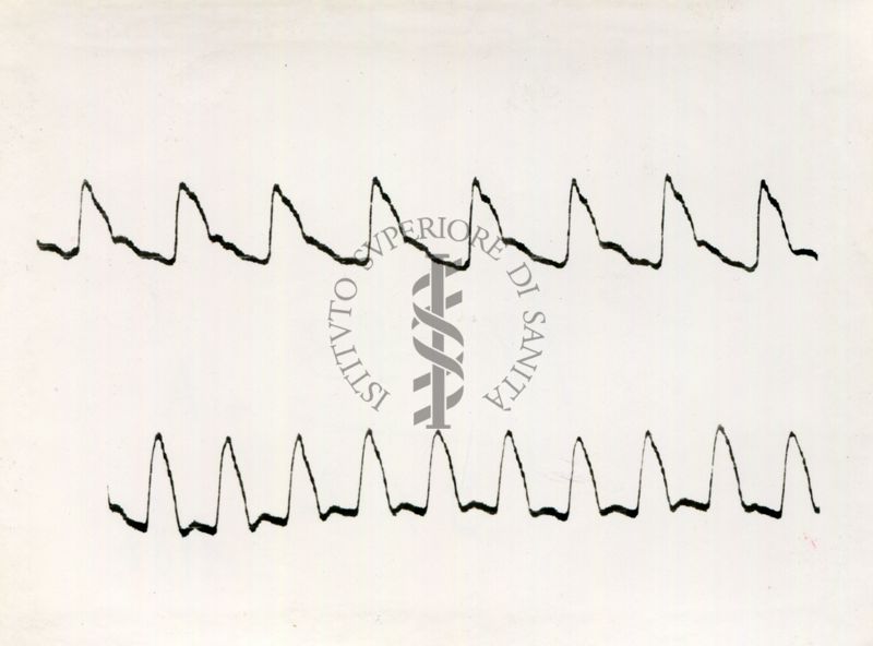 Registrazione piezografica del polso dell'arteria temporale nell'uomo sotto effetto di vari farmaci