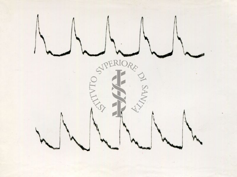 Registrazione piezografica del polso dell'arteria temporale nell'uomo sotto effetto di vari farmaci