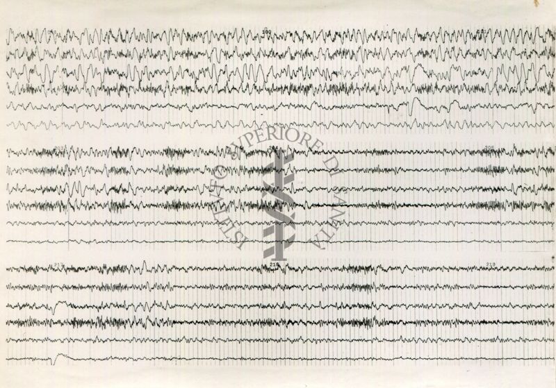 Tracciati elettroencefalografici di coniglio