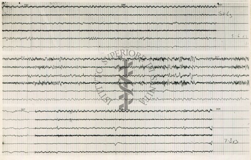 Tracciati elettroencefalografici di coniglio