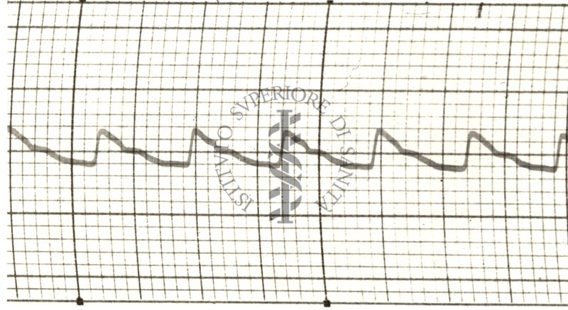 Polsazioni delle arterie nell'uomo