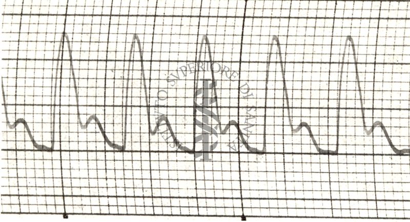 Polsazioni delle arterie nell'uomo