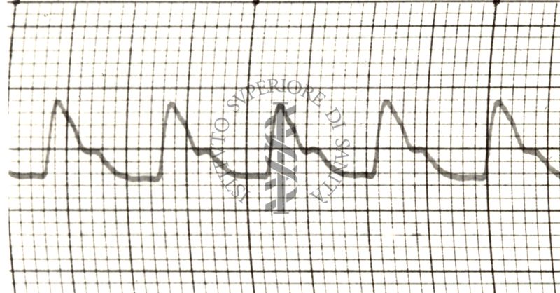 Polsazioni delle arterie nell'uomo