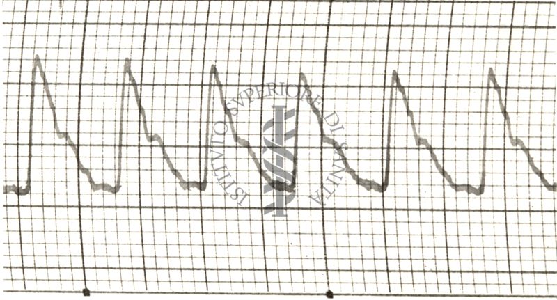 Polsazioni delle arterie nell'uomo