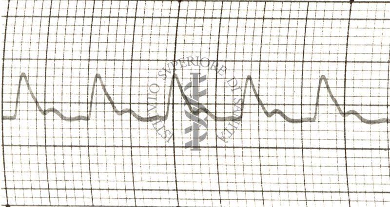 Polsazioni delle arterie nell'uomo