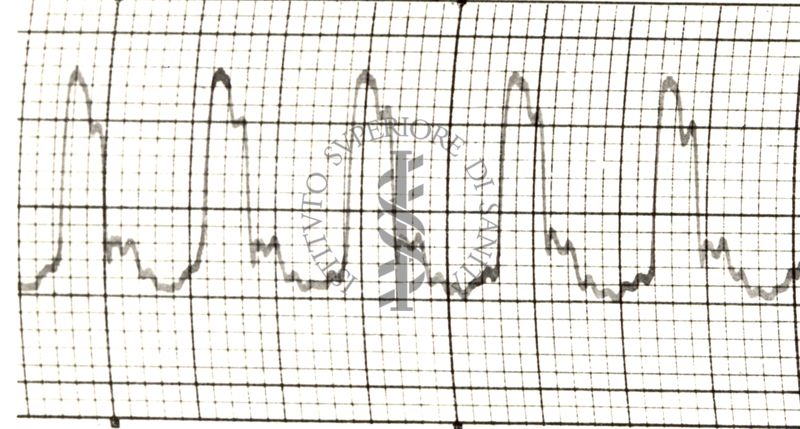 Polsazioni delle arterie nell'uomo