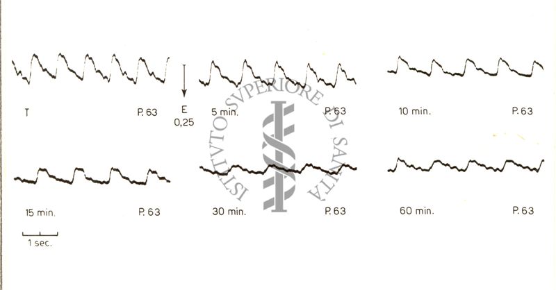 Registrazioni delle pulsazioni dell'arteria temporale nell'uomo sotto azione di vari farmaci
