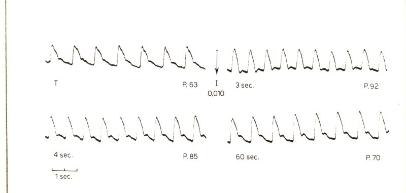 Registrazioni delle pulsazioni dell'arteria temporale nell'uomo sotto azione di vari farmaci