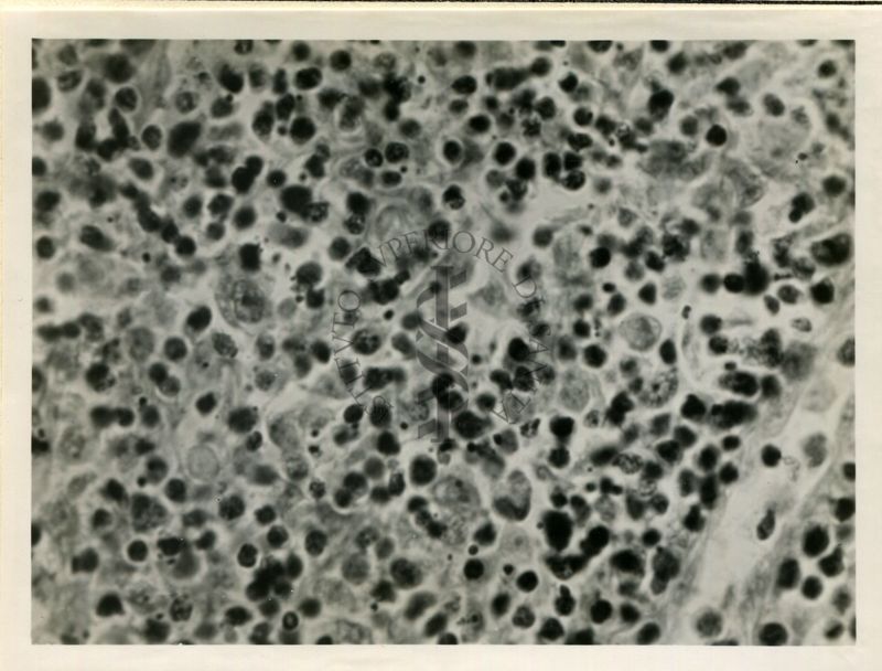 Cellule di linfoghiandole