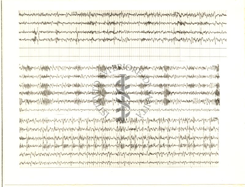 Tracciati elettroncefalografici di coniglio