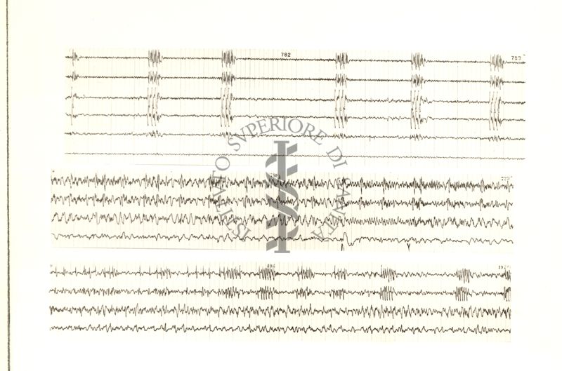 Tracciati elettroncefalografici di coniglio