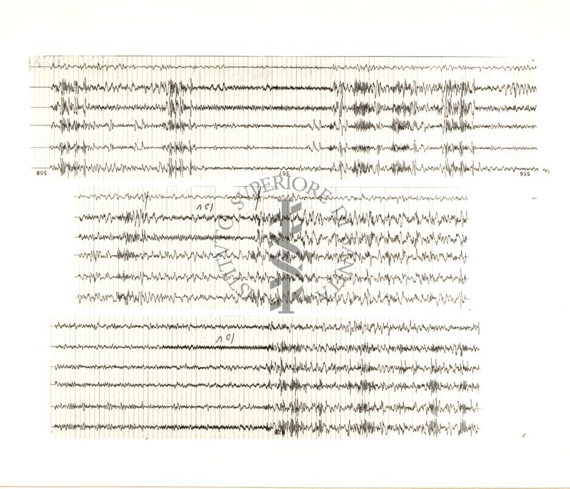 Tracciati elettroncefalografici di coniglio