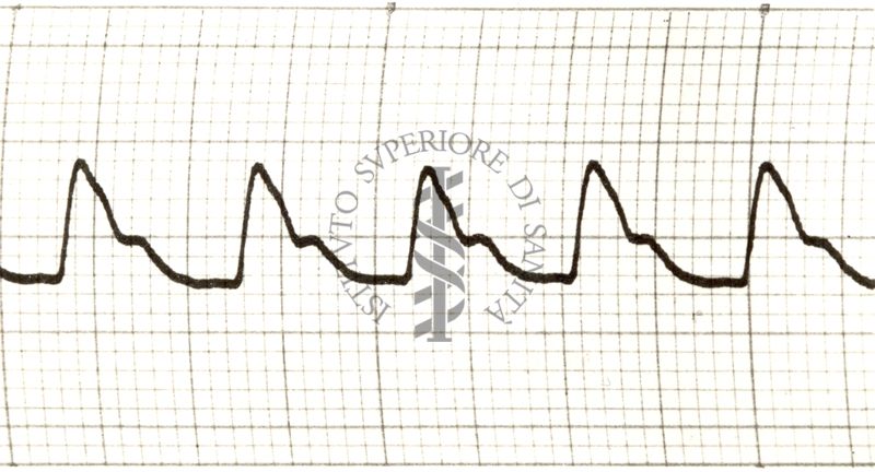 Piezosfigmogrammi delle principali arterie dell'uomo