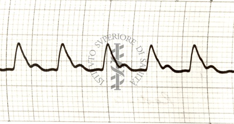 Piezosfigmogrammi delle principali arterie dell'uomo