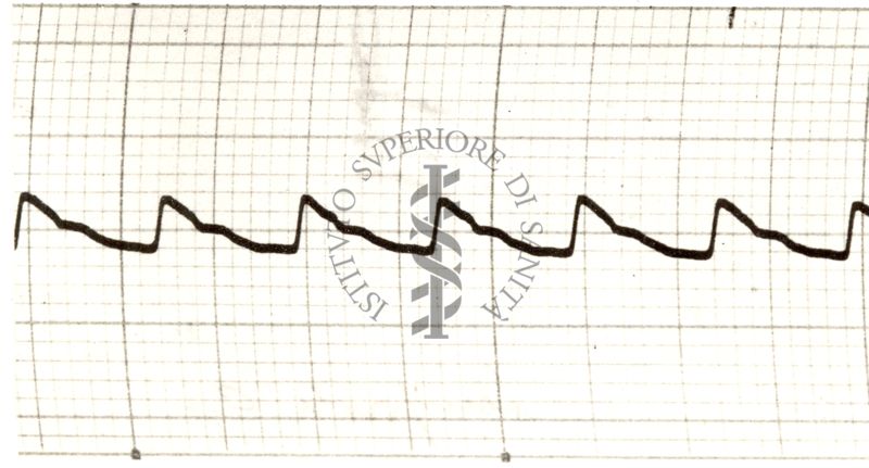 Piezosfigmogrammi delle principali arterie dell'uomo