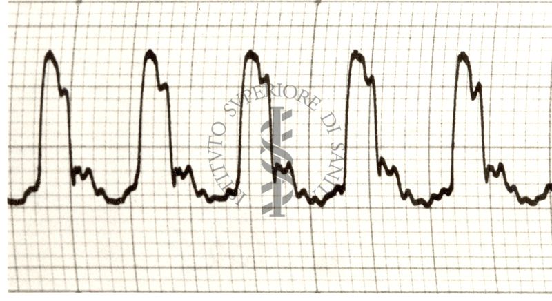 Piezosfigmogrammi delle principali arterie dell'uomo