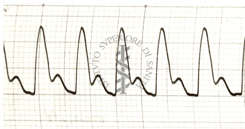 Piezosfigmogrammi delle principali arterie dell'uomo