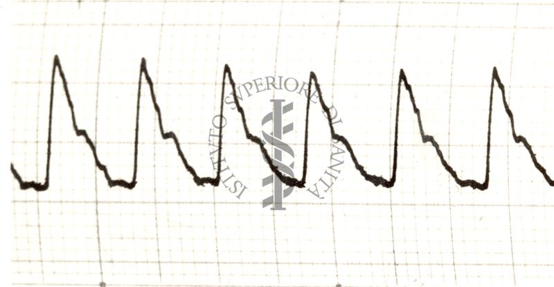 Piezosfigmogrammi delle principali arterie dell'uomo