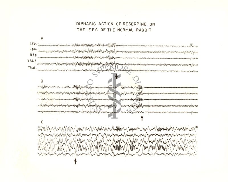 Azione della Reserpina sull'E.E.G.