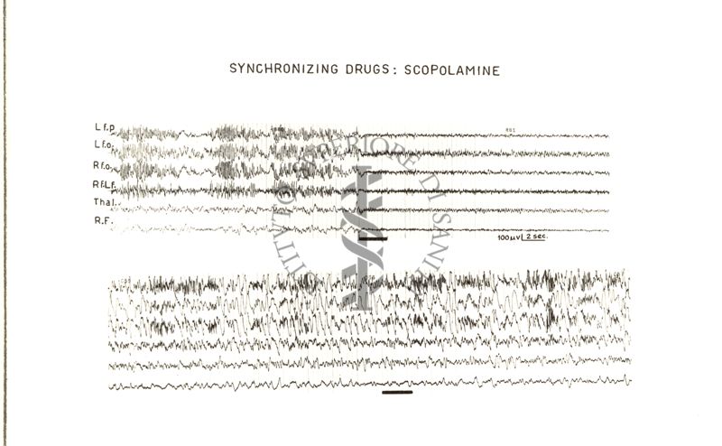 Azione della scopolamina sull'E.E.G.