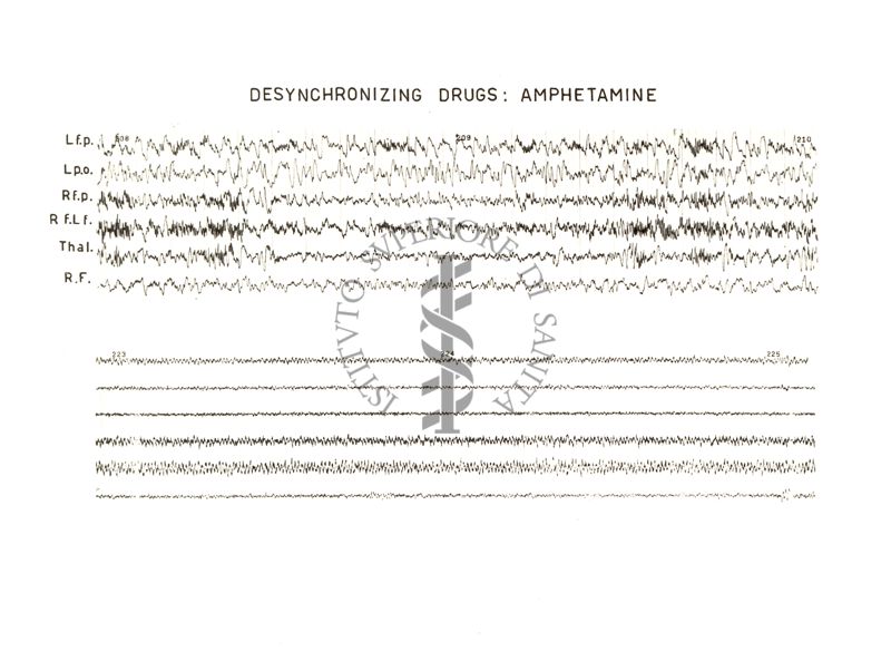 Azione della Anfetamina sull'E.E.G.