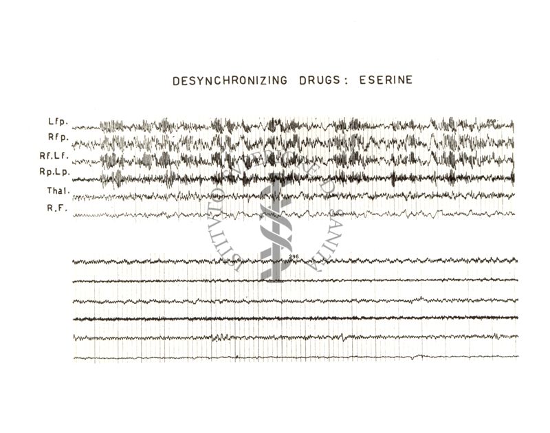 Azione dell'Eserina sull'E.E.G.