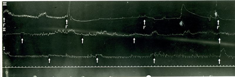 Tracciato che mostra l'azione delle acque minerali di Fiuggi sulla vescica del coniglio