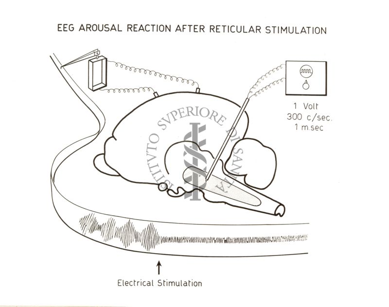 Reazione di risveglio E.E.G. dopo stimolazione elettrica dell'ipotalamo